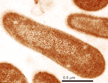 Genome Sequence of the Radioresistant Bacterium Deinococcus