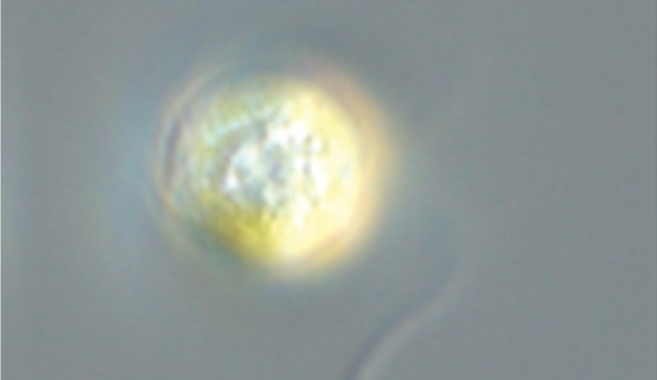 Micrograph of a small yellow alga with a white spot at its center.