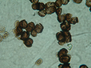 Black spheres against a white backdrop.