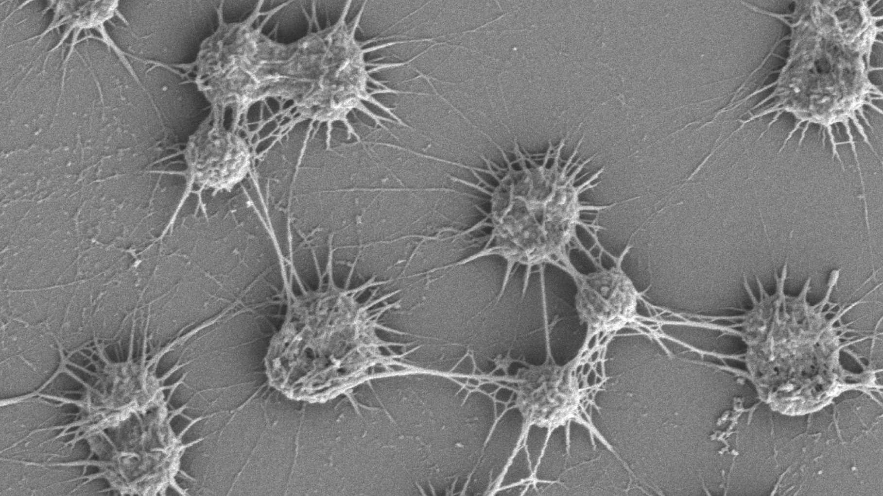 A grey microscopy photo taken at micron-scale. Microbes shown are small, round and slightly spiky in shape.