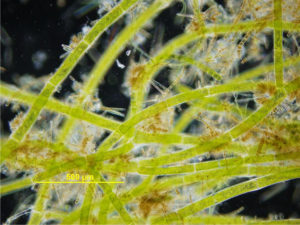 Algal light microscope image.