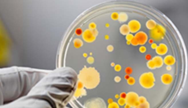 A close up image of a hand holding a dish of yellow samples