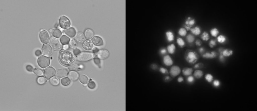 a close up of yeast cells