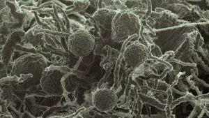 A micrograph of Neocallimastix californiae.