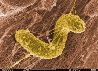 Color-enhanced photo from SEM image of sulfate-reducing Desulfovibriodesulfuricansin a biofilm matrix. (Image courtesy of PNNL via Flickr/Creative Commons)
