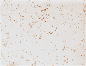 browntide-aureococcus
