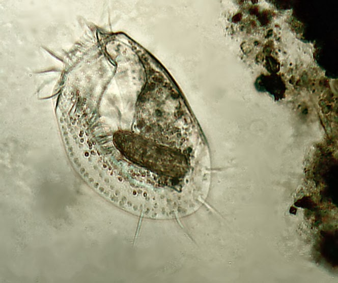 The symbiont strain of Polynucleobacter necessarius lacks many genes that the free-living strain of the bacterium has, relying on its host, the ciliated protist, Euplotes (pictured above) for those functions.  Image by Guiseppe Vago, via Flickr.