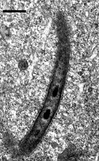 Endosymbiotic Polynucleobacter bacterium living in the cytoplasm of the ciliate Euplotes harpa. Two of the 6 to 10 electron-dense nucleoids are well visible in this thin section. The genus name of the bacteria refers to these multiple nucleoids. Scale bar, 1 µm. Courtesy of Claudia Vannini, University of Pisa, Italy.