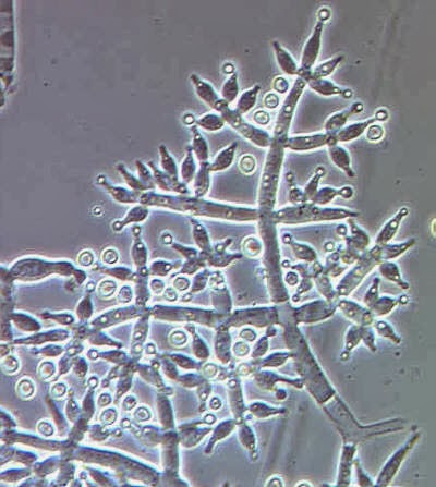 One of the enzyme genes studied was tagged in the genome of Trichoderma, a genus of fungi commonly found in forest and agricultural soils. Image courtesy of U.S. Department of Agriculture, Agricultural Research Service, Systematic Botany and Mycology Laboratory, via Wikimedia Commons.