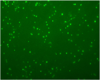 Photo: Fluorescence in situ hybridisation (FISH) image of acI Actinobacteria in water from Lake Geirneggsee, Austria, Courtesy of Raju Sekar
