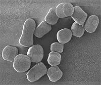 SEM of Arthrobacter chlorophenolicus Scanning electron micrograph of Arthrobacter chlorophenolicus cells