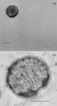 Electron micrographs of desulfurococcus cells of strain Z-1312T. (a) Negatively stained whole cell showing a single flagellum. (b) Thin section. Bars, 0.5 µm. Image from Perevalova, A. A., et al., Int J Syst Evol Microbiol 55:995-999, 2005, reproduced by permission.