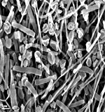 Scanning electron micrograph of the Obsidian Pool enrichment culture.