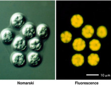 Composite of the same Aurantiochytrium limacinum cell seen through Nomarski view (left) and fluorescence view (left) Aurantiochytrium limacinum photo courtesy Daisuke Honda, Konan University
