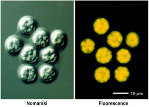 Composite of the same Aurantiochytrium limacinum cell seen through Nomarski view (left) and fluorescence view (left) Aurantiochytrium limacinum photo courtesy Daisuke Honda, Konan University