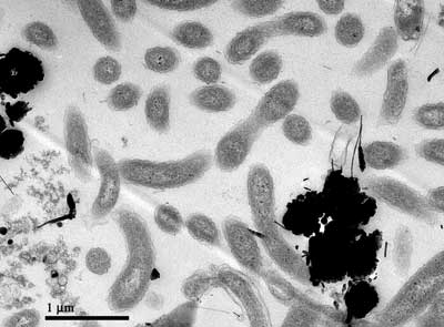 Selenospirillum indicus strain S5. Micrograph courtesy Elisabetta Bini.