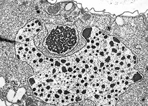 Electron micrograph of T. thermophila showing both the micronucleus and (partly surrounding it) the macronucleus. Image courtesy Yifan Liu, Univ. of Michigan