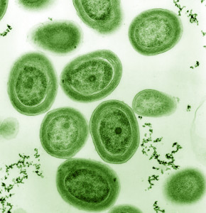 Electron micrograph of a cultured strain of Prochlorococcus