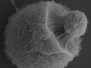 Cryptococcus neoformans giant cell SEM