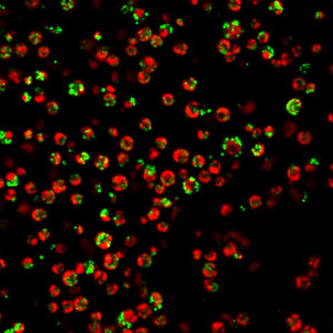 Algal cells of Chlamydomonas reinhardtii grown under nitrogen starvation conditions to produce lipids. The red is the autofluorescence from the chlorophyll of the cells while the green indicates the lipid bodies following lipid staining with Lipidtox Green. (Image prepared by Rita Kuo.)