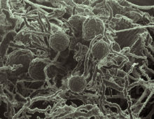 Scanning electron micrograph (SEM) of Neocallimastix californiae, a representative of the Neocallimastigomycetes, a clade of the early-diverging fungal lineages that are not well-studied. It's one of three Neocallimastigomycetes sequenced and annotated by the DOE JGI for this study. (Chuck Smallwood, PNNL)