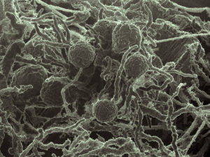 Scanning electron micrograph (SEM) of Neocallimastix californiae, a representative of the Neocallimastigomycetes, a clade of the early-diverging fungal lineages that are not well-studied. It's one of three Neocallimastigomycetes sequenced and annotated by the DOE JGI for this study. (Chuck Smallwood, PNNL)