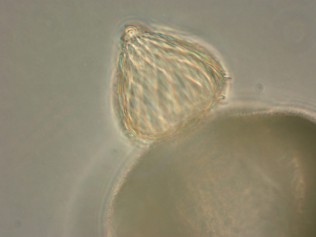 Blyttiomyces helicus on spruce pollen grain. (Joyce Longcore)