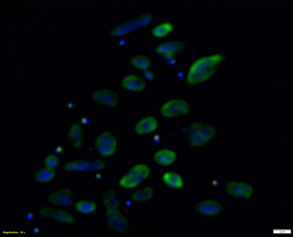 FISH of Nha-C enrichment with Hrr. lacusprofundi ACAM34-hmgA. Fluorescence micrograph shows individual Nha-C cells amongst Hrr. lacusprofundi cells. Nha-C cells labelled with a Cy5 (red fluorescence) conjugated probe; Hrr. lacusprofundi cells labelled with a Cy3 (yellow fluorescence, recolored to green to improve contrast) probe; all nucleic-acid containing cells stained with DAPI (blue fluorescence). Composite image of all three filters. Scale bars represent 2 µm. (Josh Hamm, UNSW)
