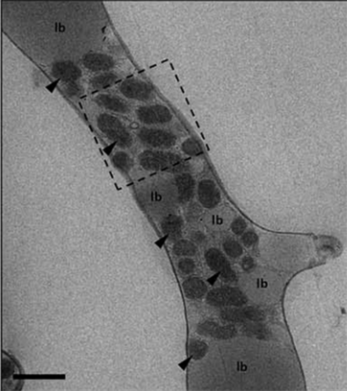Related to Uehling’s proposal: Transmission electron microscopy of Mycoavidus cysteinexigens (arrows) aggregated around lipid bodies (lb) inside hyphae of Mortierella elongata isolate NVP64. Scale bar 1 um. (Alessandro Desiro)