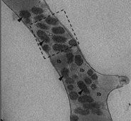 Transmission electron microscopy of Mycoavidus cysteinexigens (arrows) aggregated around lipid bodies (lb) inside hyphae of Mortierella elongata isolate NVP64. Scale bar 1 um. (Alessandro Desiro)