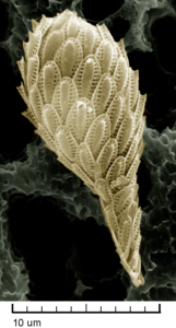 A synurophyte, Synura petersenii, with its silica scales. False-colored. (Drew Lindow, CC BY-SA 3.0)