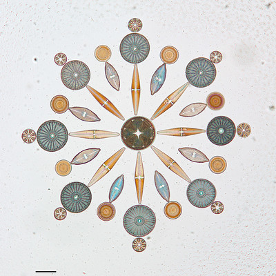 Diatoms arranged in a symmetric pattern, like the Victorians used to do back in the day. (W.M. Grant)