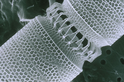 Zooming in on a marine diatom, Detonula pumila, you can see the mesh-like nanoscale patterning on its shell surface. (Health Sciences and Nutrition, CSIRO)