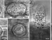 From Sekimoto et al., 2011: Olpidium bornovanus, a unicellular fungus, is an obligate parasite of plants that reproduces with flagellated, swimming zoospores. A-B. Vegetative unicellular thalli in cucumber root cells. Thalli differentiate into sporangia with zoospores, or into resting spores. C. An empty sporangium, after zoospore release. D. A thick-walled resting spore. E. Zoospores being released from a sporangium, showing the sporangium exit tube (arrowheads). F. A swimming zoospore with a single posterior flagellum. G. An encysted zoospore. Bars: A-E = 10 μm; F,G = 5 μm. (Figures are from Sekimoto et. al., 2011 used under a Creative Commons Attribution 2.0 License.)