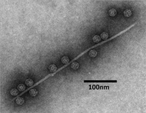 RNA virus particles, the dark spheres in the image, belong to the family Leviviridae. Here, they’re caught clinging to a fragment of a microbial appendage: a pilus.