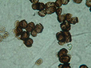 A microscopic image showing a cluster of black cells, which are black fungi.