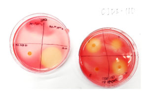 Two Petri dishes against a white background. One on the right shows minor pink stain; the one on the left shows significant pink stain.